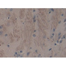 A Disintegrin And Metalloproteinase With Thrombospondin 2 (ADAMTS2) Antibody