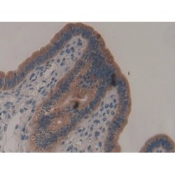 A Disintegrin And Metalloproteinase With Thrombospondin 2 (ADAMTS2) Antibody