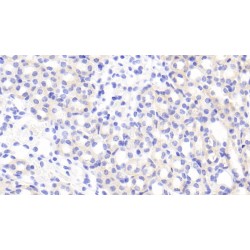 A Disintegrin And Metalloproteinase With Thrombospondin 2 (ADAMTS2) Antibody