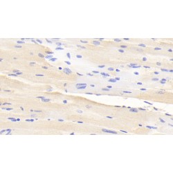 A Disintegrin And Metalloproteinase With Thrombospondin 2 (ADAMTS2) Antibody