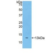 Western blot analysis of recombinant Human ADAMTS7.