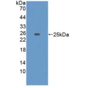 Western blot analysis of recombinant Mouse ADAMTS7.