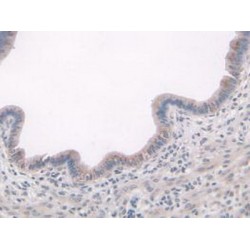 A Disintegrin And Metalloproteinase With Thrombospondin 7 (ADAMTS7) Antibody