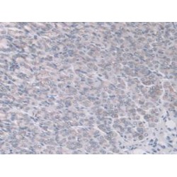 A Disintegrin And Metalloproteinase With Thrombospondin 7 (ADAMTS7) Antibody