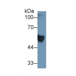 Carcinoembryonic Antigen Related Cell Adhesion Molecule 1 (CEACAM1) Antibody