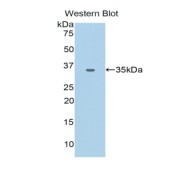 Western blot analysis of recombinant Human CEACAM1.