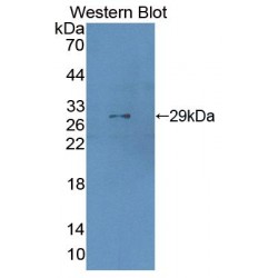 Signaling Lymphocytic Activation Molecule Family, Member 5 (SLAMF5) Antibody