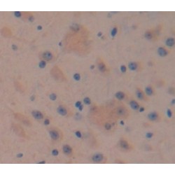 A Disintegrin And Metalloproteinase With Thrombospondin 12 (ADAMTS12) Antibody