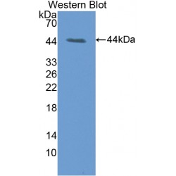 Dolichyl Diphosphooligosaccharide Protein Glycosyltransferase (DDOST) Antibody