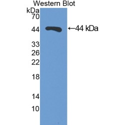 Dolichyl Diphosphooligosaccharide Protein Glycosyltransferase (DDOST) Antibody