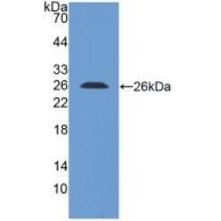 Leukocyte Immunoglobulin Like Receptor Subfamily B, Member 1 (LILRB1) Antibody