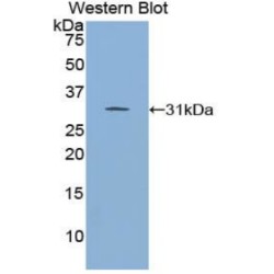 Inhibitor of Nuclear Factor Kappa B Kinase Interacting Protein (IKBIP) Antibody