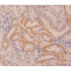 Inhibitor of Nuclear Factor Kappa B Kinase Interacting Protein (IKBIP) Antibody