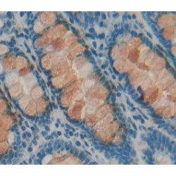 Eukaryotic Translation Initiation Factor 4E Binding Protein 1 (EIF4EBP1) Antibody