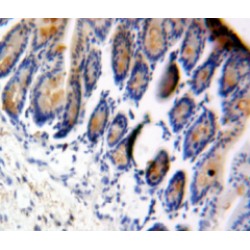 Eukaryotic Translation Initiation Factor 4E Binding Protein 1 (EIF4EBP1) Antibody