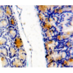 Eukaryotic Translation Initiation Factor 4E Binding Protein 1 (EIF4EBP1) Antibody