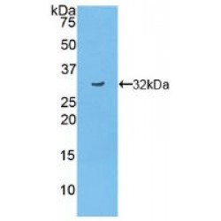 Tumor Necrosis Factor Alpha Induced Protein 3 Interacting Protein 2 (TNIP2) Antibody