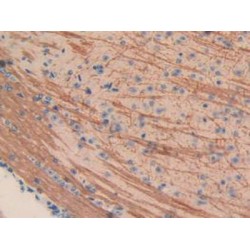 Tumor Necrosis Factor Alpha Induced Protein 3 Interacting Protein 2 (TNIP2) Antibody