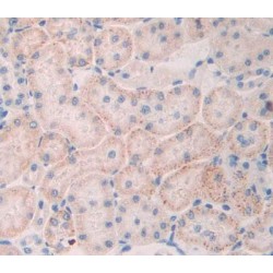 Tumor Necrosis Factor Alpha Induced Protein 3 Interacting Protein 2 (TNIP2) Antibody