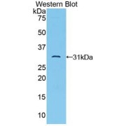 Western blot analysis of the recombinant protein.