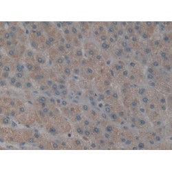 Mitogen Activated Protein Kinase Kinase Kinase 7 Interacting Protein 1 (MAP3K7IP1) Antibody