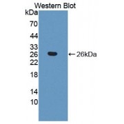 Western blot analysis of recombinant Cow THBS1 Protein.