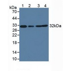 Complement C1q Binding Protein (C1QBP) Antibody