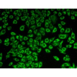 Complement C1q Binding Protein (C1QBP) Antibody