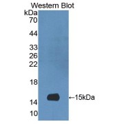 Western blot analysis of the recombinant protein.