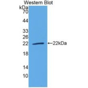 Western blot analysis of the recombinant protein.