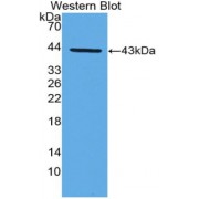 Western blot analysis of the recombinant protein.