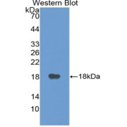 Western blot analysis of the recombinant protein.