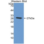 Western blot analysis of recombinant Cow CRP using C Reactive Protein (CRP) Antibody.