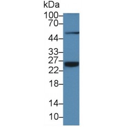 C Reactive Protein (CRP) Antibody