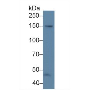 Western blot analysis of Human 304 cell lysate, using Cow NOS3 Antibody (5 µg/ml) and HRP-conjugated Goat Anti-Rabbit antibody (<a href="https://www.abbexa.com/index.php?route=product/search&amp;search=abx400043" target="_blank">abx400043</a>, 0.2 µg/ml).