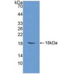 Fatty Acid Binding Protein 3, Muscle And Heart (FABP3) Antibody
