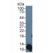 Western blot analysis of Human A431 cell lysate, using Cow S100A2 Antibody (3 µg/ml) and HRP-conjugated Goat Anti-Rabbit antibody (<a href="https://www.abbexa.com/index.php?route=product/search&amp;search=abx400043" target="_blank">abx400043</a>, 0.2 µg/ml).