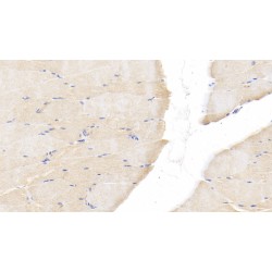 Interleukin 1 Beta (IL1b) Antibody