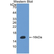 Western blot analysis of the recombinant protein.