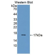 Western blot analysis of the recombinant protein.