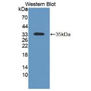 Western blot analysis of the recombinant protein.