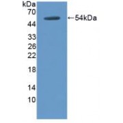 Western blot analysis of recombinant Dog thrombomodulin.