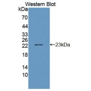 Western blot analysis of the recombinant protein.