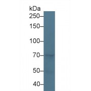 Western blot analysis of Dog Liver lysate, using Dog NOS3 Antibody (3 µg/ml) and HRP-conjugated Goat Anti-Rabbit antibody (<a href="https://www.abbexa.com/index.php?route=product/search&amp;search=abx400043" target="_blank">abx400043</a>, 0.2 µg/ml).