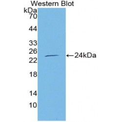 Nitric Oxide Synthase, Endothelial (NOS3) Antibody