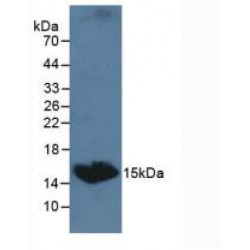 Thyroid Stimulating Hormone Beta (TSHb) Antibody