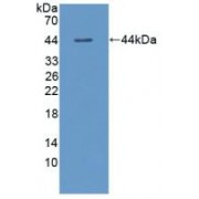 Western blot analysis of recombinant Dog TSHb.