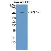 Western blot analysis of the recombinant protein.