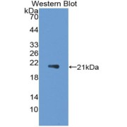 Western blot analysis of the recombinant protein.