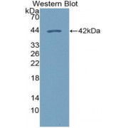 Western blot analysis of recombinant Human CXCL14 Protein.